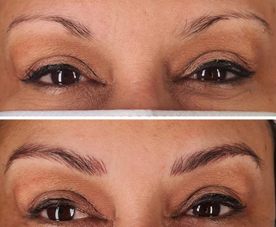 Galería Micropigmentación