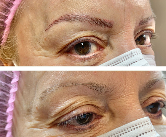 Galería Micropigmentación