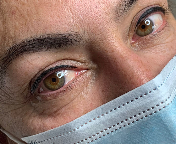 Galería Micropigmentación